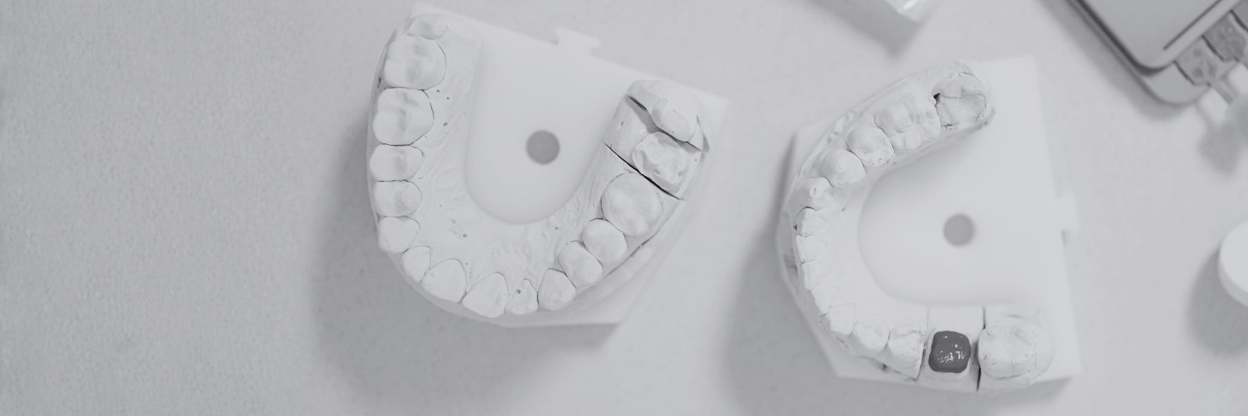 Full Mouth Rehabilitation | Dentist