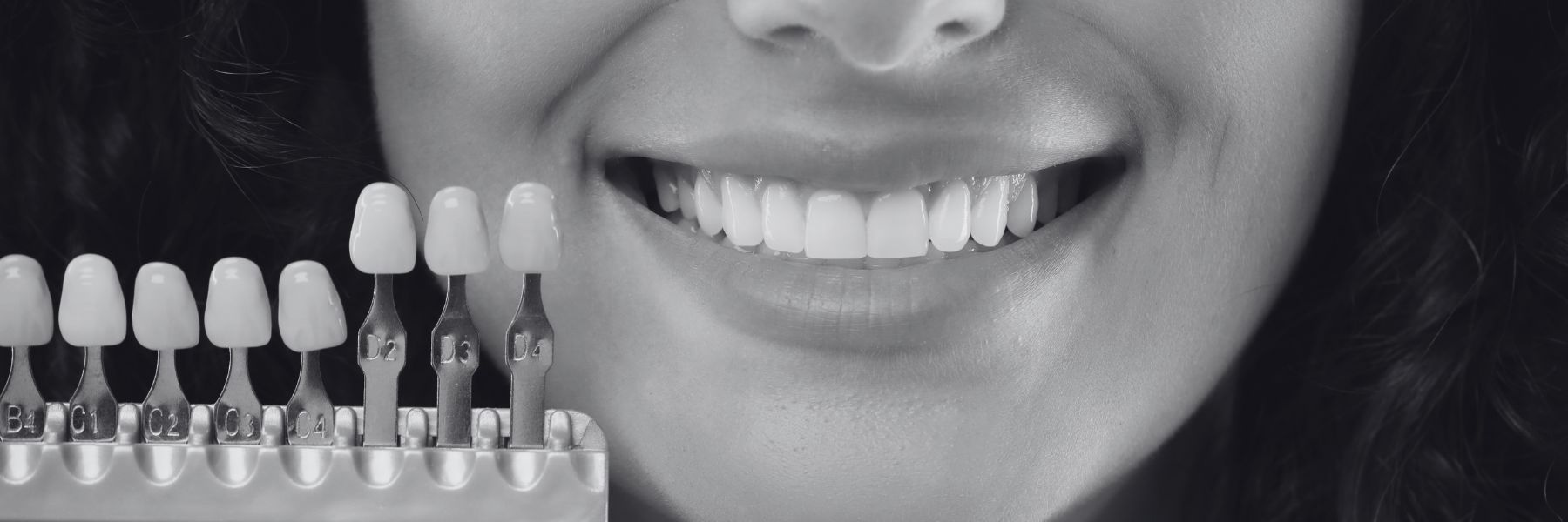 Laser Dentistry | Dentist